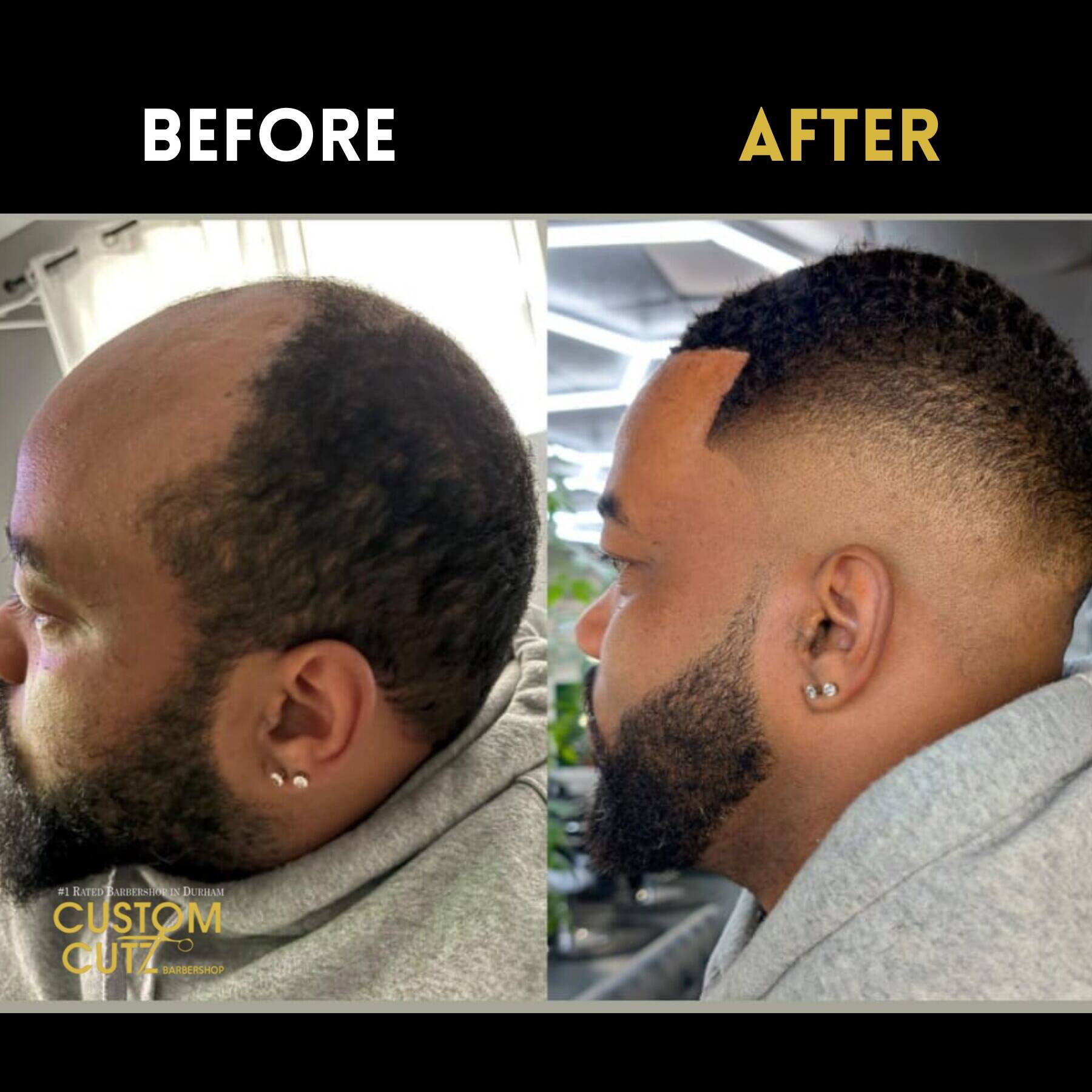 Ajax hair unit client – top view of seamless result
