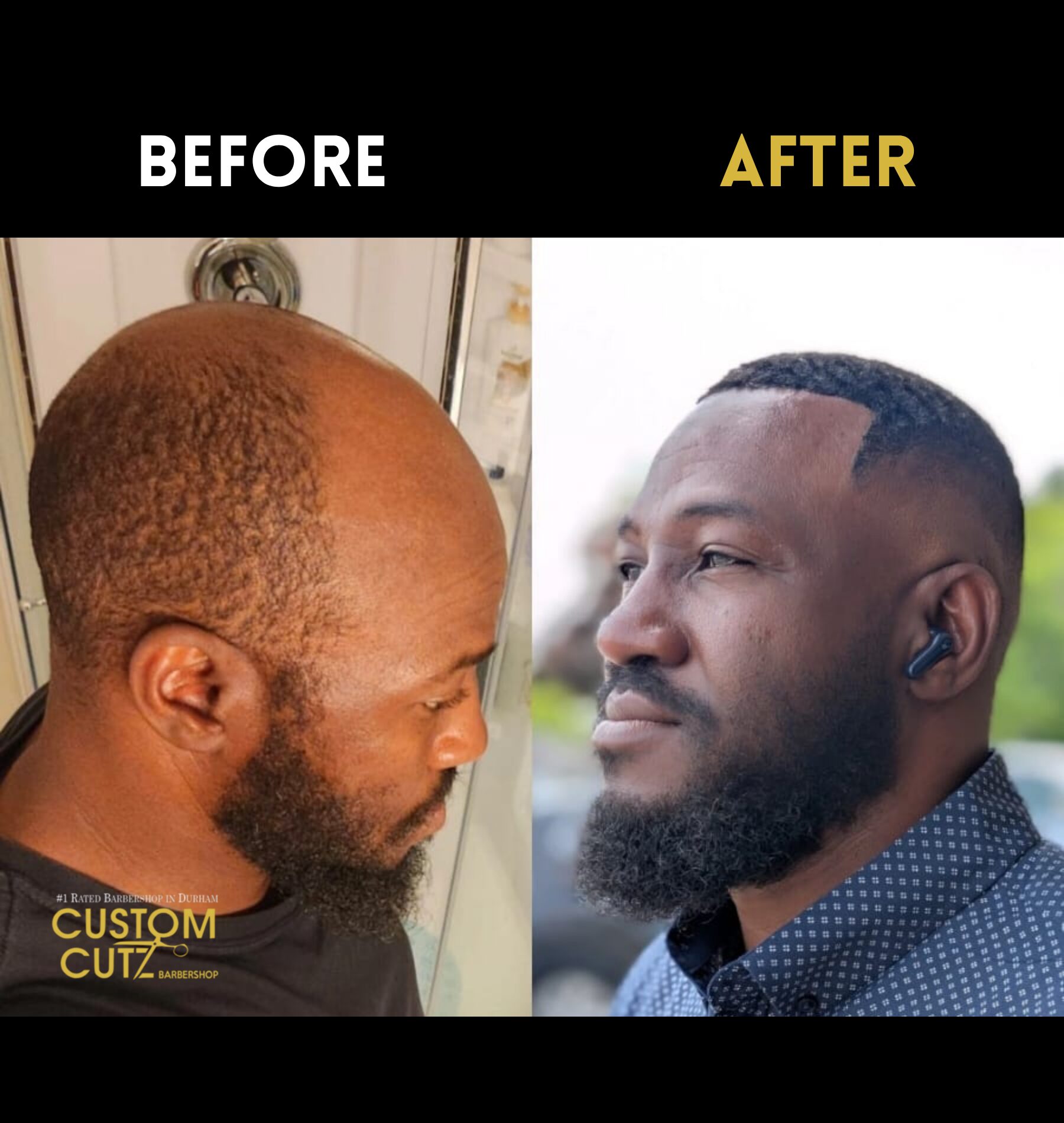 Close-up of hair replacement system on Oshawa client