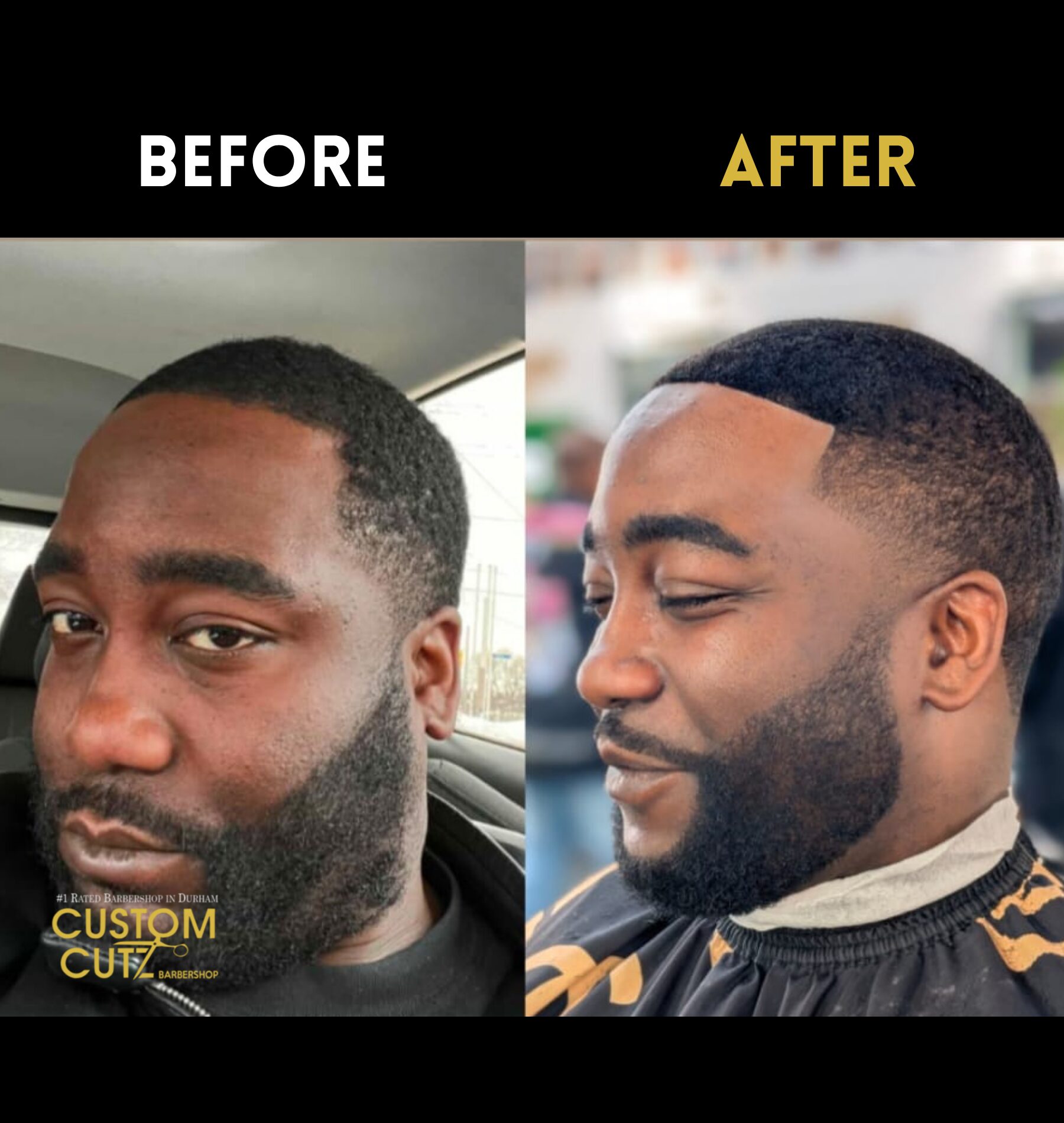 Client smiling with a fresh hair system install in Ajax