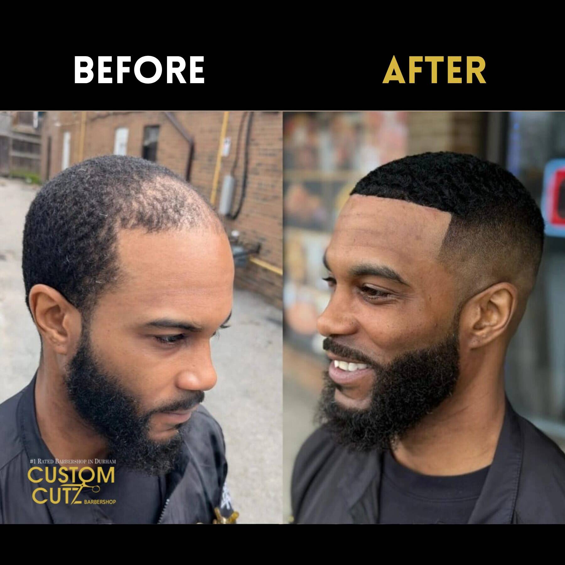 Before and after of a men’s hair unit in Pickering, Ontario